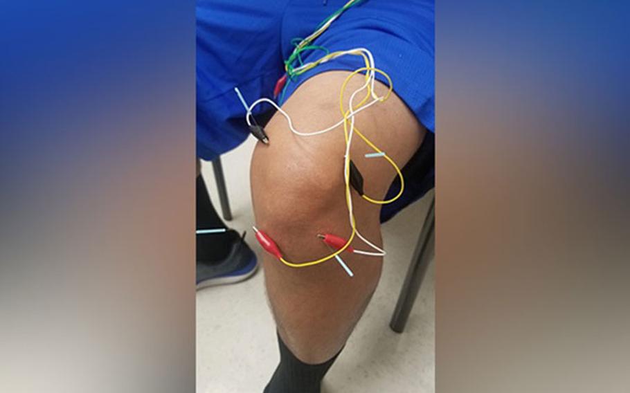 A U.S. service member gets treated with elector acupuncture as adjunctive treatment of chronic knee pain and to assist with rehabilitation that is part of the larger DHA effort to change how it manages pain. Photo credit: Rebecca Westfall, U.S. Army Medical Command.